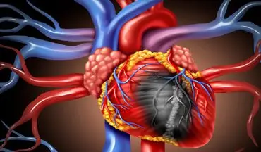 علائم اولیه بیماری چربی قلب را بشناسید