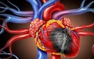 علائم اولیه بیماری چربی قلب را بشناسید