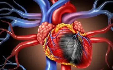 علائم اولیه بیماری چربی قلب را بشناسید