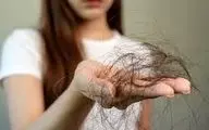 اگر ریزش مو دارید حتما بخوانید!