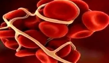 علل تشکیل لخته در عروق چیست؟