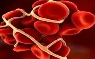 علل تشکیل لخته در عروق چیست؟