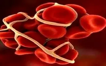 علل تشکیل لخته در عروق چیست؟