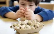 راهکاری برای کاهش احتمال آلرژی غذایی در کودکان