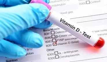 نشانه ها و علائم کمبود ویتامین D در بدن