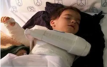 اعتراض و جنجال بر سر اشتباه در جراحی دست کودک 2 ساله 