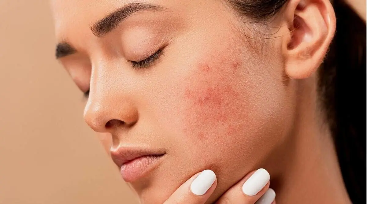 راه های از بین بردن لکهای پوستی !