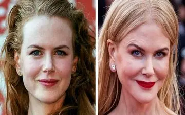 چهره‌ی قبل از جراحی زیبایی ده زن مشهور سینما لو رفت
