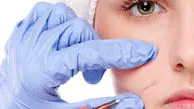 روند تزریق چربی چجوری است؟