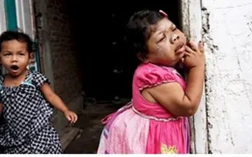 
حادثه ای عجیب / باورتان می شود این دختر 24 ساله باشد؟! + عکس