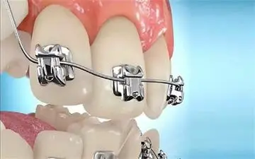 اصلاح عیوب دندان با کمک فناوری نانو در کشور