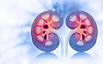  خطر ابتلا به سنگ کلیه با کار کردن در شیفت شب