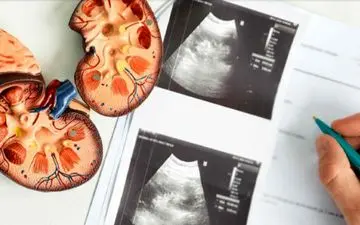 تاثیر آسیب حاد کلیه بر سلامت مغز

