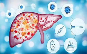 هپاتیت چیست و چه راه‌هایی برای انتقال آن وجود دارد؟