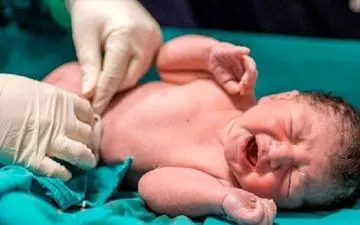 کدام زایمان عوارضش کمتر است؟