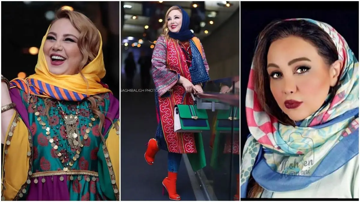 جراحی زیبایی صورت بهنوش بختیاری / بهنوش خانم با چهره کاملاً جدید + عکس