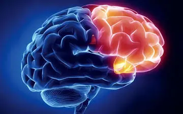 سکته مغزی از علائم تا توصیه‌های پیشگیرانه