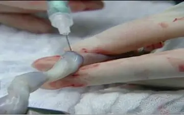 چگونه سلول هایمان را پس انداز کنیم؟ 