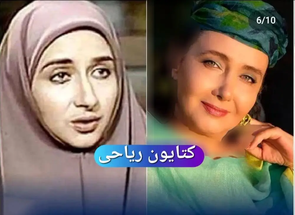 عکس بازیگران زن ایرانی قبل و بعد از عمل زیبایی
