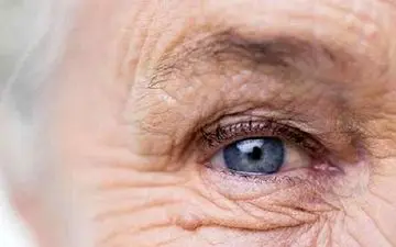 این علائم عجیب نشانه آب مروارید است