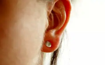 عوامل بزرگ شدن یا پارگی سوراخ لاله گوش