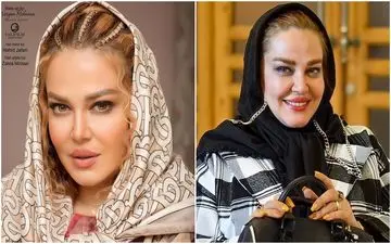 چهره عجیب و باورنکردنی بهاره رهنما بعد از عمل جراحی / بهاره 18 ساله شد + عکس