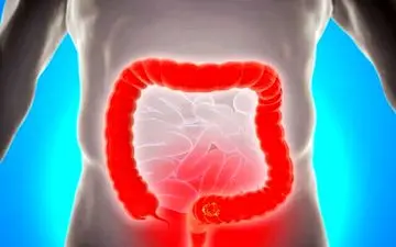 راهکارهایی برای افزایش باکتری های مفید روده