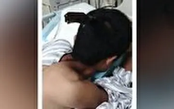 مراجعه خونسردانه یک مرد به آمبولانس با چاقویی در سر + فیلم (۱۸+) 