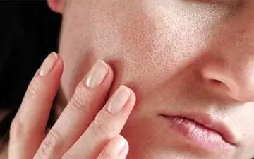 با این ویتامین صورت تان پر می شود