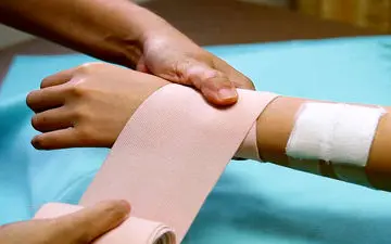 چند نکته در مورد سوختگی که باید بدانید