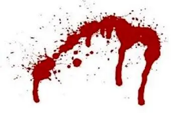 عکس متهم پرونده سرهای بریده شده خیابان شیخ بهایی