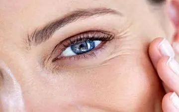 عوامل ایجاد چروک دور چشم