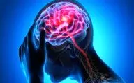 علائم سکته مغزی را بشناسید

