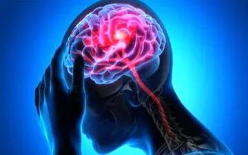 علائم سکته مغزی را بشناسید

