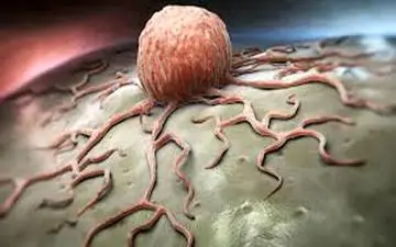 در مورد ضایعات کبد بیشتر بدانید!