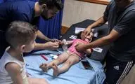 برخورد ترکش به صورت دختربچه فلسطینی در حمله هوایی صهیونیست‌ها
