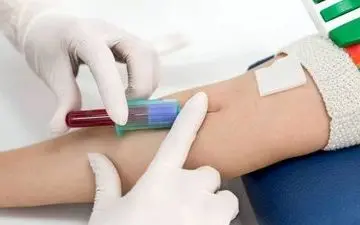 بیمه شامل خدمات آزمایشگاهی نمی شود؟