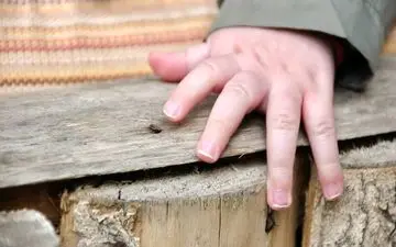 برای در آوردن ریزترین خارها از داخل پوست این ترفندهای ساده را بکار بگیر!