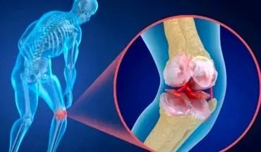 علت‌های رایج صدا دادن مفاصل !