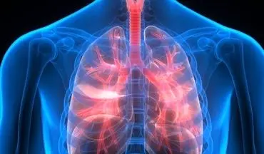 سازمان غذا و دارو: کمبود اسپری تنفسی نداریم