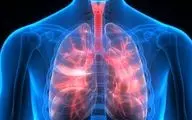 سازمان غذا و دارو: کمبود اسپری تنفسی نداریم