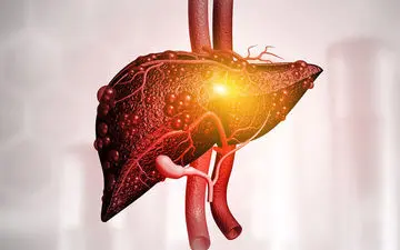 چکار کنیم به کبد چرب مبتلا نشویم؟