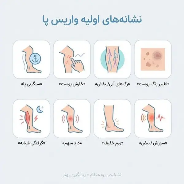 نشانه های اولیه واریس پا