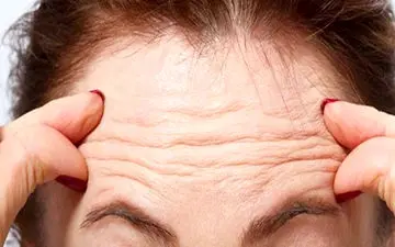 چین و چروک پوست چگونه ایجاد می‌شود؟