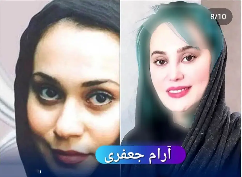 عکس بازیگران زن ایرانی قبل و بعد از عمل زیبایی