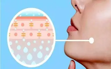 نگران پوستتان هستید؟ پس به این خوراکی ها لب نزنید!

