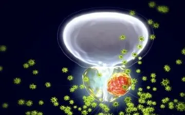 افزایش خطر سرطان پروستات در مردان به دلیل آلودگی هوا