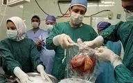 جراحی اهدای عضو از افراد دچار مرگ قلبی در این دانشگاه کشور انجام می شود