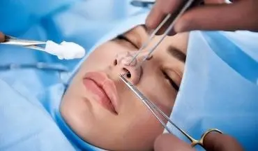شکایات از جراحی‌های زیبایی افزایش یافت