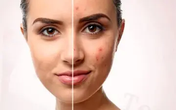 خودارضایی بر چهره تاثیر دارد؟